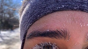 Bulu mata pun tertutup es. Foto: boredpanda