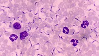 Apa yang tampak seperti tali dengan bagian berwarna biru di tengahnya adalah bentuk asli parasit Trypanosoma. (Foto: Wikimedia Common/Josef Reischig)