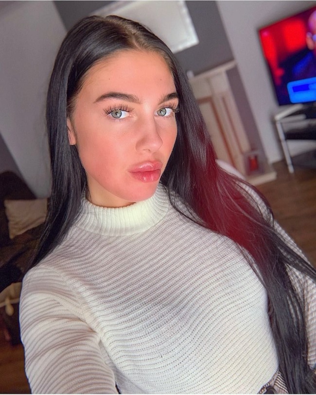 Holly kerap membagikan foto wajahnya sebelum dan sesudah mengonsumsi obat jerawat. Dia mengklaim obat tersebut membuat wajahnya kini menjadi lebih mulus.Foto: Instagram @hollycockerill