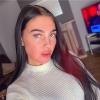 Holly kerap membagikan foto wajahnya sebelum dan sesudah mengonsumsi obat jerawat. Dia mengklaim obat tersebut membuat wajahnya kini menjadi lebih mulus.Foto: Instagram @hollycockerill