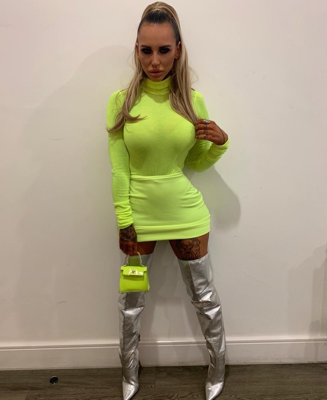 Sallie yang berusia 31 tahun itu sejauh ini sudah melakukan beberapakali operasi plastik pada hidung dan payudaranya. Meski demikian dia tetap tidak merasa puas. Dia tetap membenci hidungnya yang dianggapnya seperti ada sosis tersangkut keluar dari hidungku. Foto: Instagram