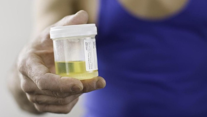 Siapa sangka urine anak IPA dan IPS beneran beda? (Foto: iStock) Siapa sangka urine anak IPA dan IPS beneran beda? (Foto: iStock)