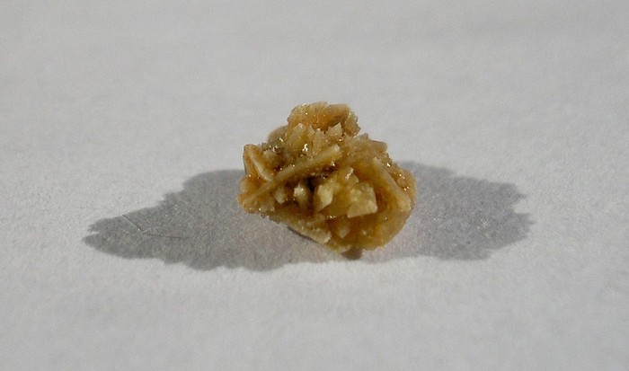 Batu ginjal ada beberapa jenis tergantung dari zat penyusunnya. Sebagian batu ginjal terdiri dari kalsium, asam urat, struvit, hingga yang langka sistin. (Foto: Wikimedia Common/ÐиÑ
аÑло ÐнÑелковиÑ)