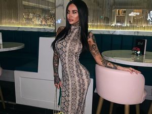 DJ Seksi Lakukan Implan di Kaki Agar Tinggi, Begini Kondisinya Saat Ini
