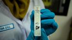 Penampakan Test Pack Diagnosis DBD yang Viral di Medsos