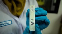 Penggunaan Kit Diagnosis Demam Berdarah Dengue (DBD) yang serupa test pack untuk uji kehamilan. (Dok. Humas BPPT)