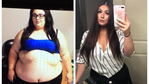 Potret Perjalanan Diet Wanita Pangkas 82 Kg, Bangkit dari Keterpurukan
