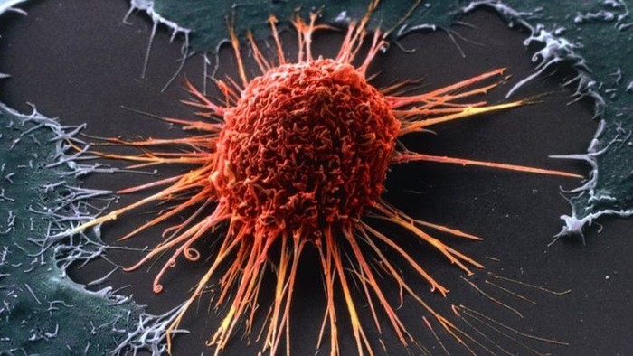Ditemukan Obat Baru Efektif Sembuhkan Pasien Kanker Stadium Lanjut