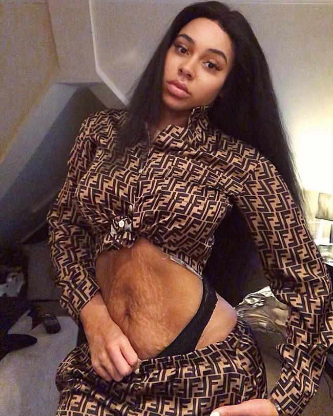 Pernah ada satu brand yang mengedit stretch mar-ku dan aku tidak ingin bekerja dengan mereka lagi. Industri sedang mengalami titik balik yang besar sekarang ini, pungkas Chelsea. (Foto: Instagram/@ccokez)