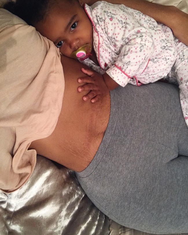 Setelah melahirkan, Chelsea memiliki jejak stretch mark di perutnya. Ia pun mempostingnya di Instagram namun mendapat banyak komentar pedas. Ada pria mengatakan ew dan wanita mengatakan, pria tidak akan mau melihatnya, tapi aku tidak melakukan ini demi pria, semuanya berjalan begitu saja di kepalaku, ujarnya kepada The Sun. (Foto: Instagram/@ccokez)