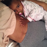 Setelah melahirkan, Chelsea memiliki jejak stretch mark di perutnya. Ia pun mempostingnya di Instagram namun mendapat banyak komentar pedas. Ada pria mengatakan ew dan wanita mengatakan, pria tidak akan mau melihatnya, tapi aku tidak melakukan ini demi pria, semuanya berjalan begitu saja di kepalaku, ujarnya kepada The Sun. (Foto: Instagram/@ccokez)