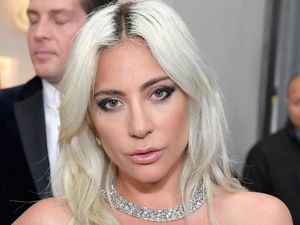 Lady Gaga Bela Cardi B yang Dibully Setelah Menang Grammy