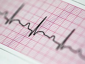 Siapa Saja yang Perlu Cek D-dimer? Ini Kata Dokter Jantung