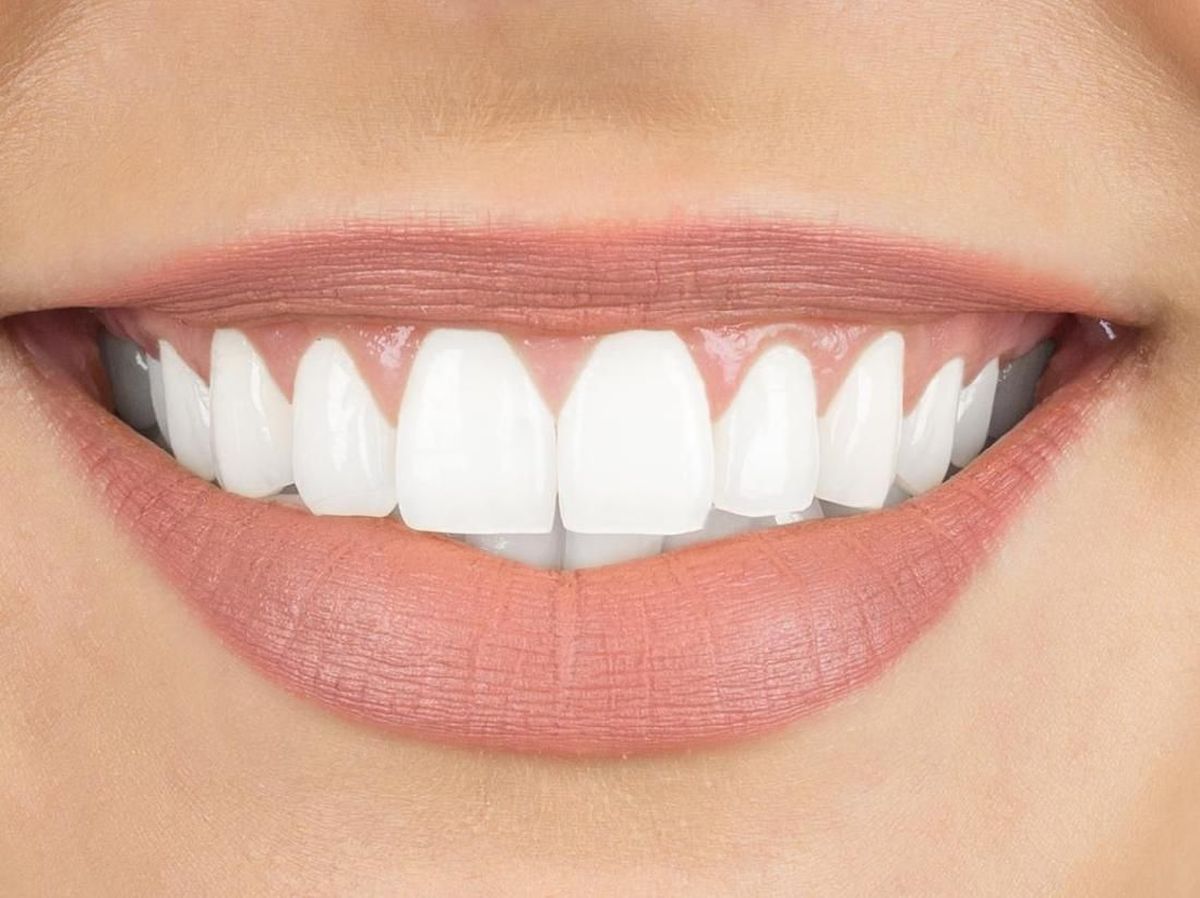 Cara Memutihkan Gigi Kuning Menggunakan Pemutih Gigi Alami