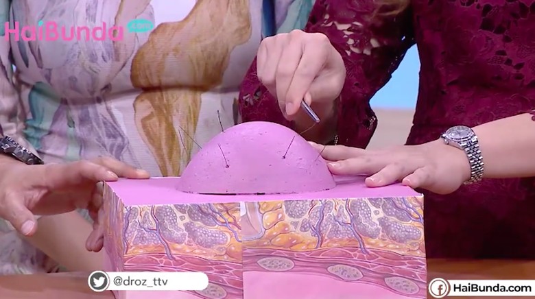 Bahaya mencabut rambut halus di payudara/ Foto: HaiBunda Bahaya mencabut rambut halus di payudara/ Foto: HaiBunda