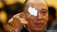 Usai mencoblos dan memasukan surat suara, warga tak lupa mencelupkan jari ke tinta ungu.