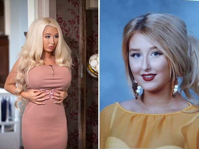 Amanda Ahola, wanita asal Finlandia yang terobsesi jadi Barbie hidup. Penampilan dulu yang masih alami sudah berbeda jauh dari yang sekarang. Berbagai sudut tubuhnya sudah di-vermak, dan hasilnya penampilan wanita 22 tahun itu terlihat ekstrem. Foto: dok. YouTube