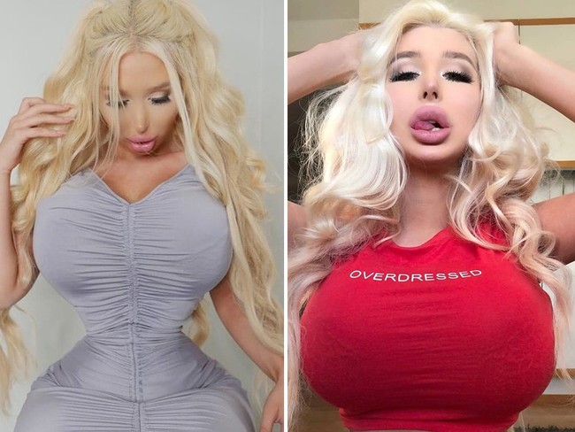 Amanda terobsesi punya payudara sebesar mungkin. Dia memutuskan untuk menambah ukuran payudaranya menjadi 30GG. Saya berhasil melakukan operasi plastik, tapi setelah itu saya mengalami koma beberapa hari setelah operasi plastik, ujarnya kepada Barcroft pada 2017 silam. Foto: Instagram