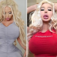 Amanda terobsesi punya payudara sebesar mungkin. Dia memutuskan untuk menambah ukuran payudaranya menjadi 30GG. Saya berhasil melakukan operasi plastik, tapi setelah itu saya mengalami koma beberapa hari setelah operasi plastik, ujarnya kepada Barcroft pada 2017 silam. Foto: Instagram