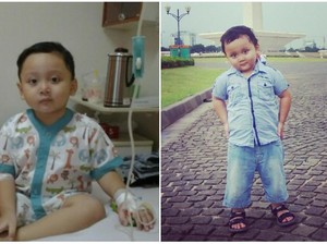 Awalnya Dikira DBD, Tak Tahunya Bima Idap Leukemia