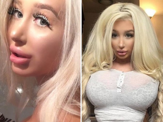 Aku bisa mengatakan bahwa operasi plastik rasanya lebih baik dibanding seks, ucapnya di acara reality show Botched yang tayang di E!. Mendapatkan implan menjadi hari terbaik di dalam hidupku, aku ingin memiliki (payudara) yang lebih besar lagi, tambahnya. Foto: Instagram