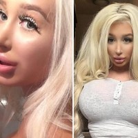 Aku bisa mengatakan bahwa operasi plastik rasanya lebih baik dibanding seks, ucapnya di acara reality show Botched yang tayang di E!. Mendapatkan implan menjadi hari terbaik di dalam hidupku, aku ingin memiliki (payudara) yang lebih besar lagi, tambahnya. Foto: Instagram