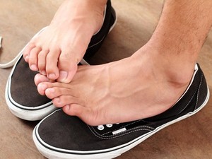 Kaki Gatal dan Bersisik? Awas, Kena Pernyakit Athletes Foot