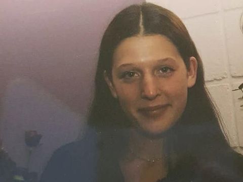 Perubahan Gila-gilaan Wanita yang Menjalani Operasi Plastik Selama 21 Tahun