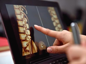 Skoliosis di Atas 70 Derajat Bisa Picu Kerusakan Organ, Butuh Operasi