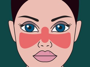 Mengenal Penyakit Lupus, Gejala, Penyebab, Pencegahan, dan Pengobatannya