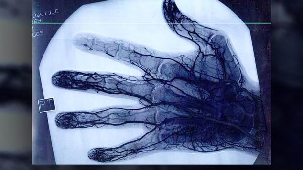 Courtesy of Dave Schulte via Livescience