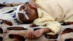 Miris! Lebih Dari 80 Ribu Anak-anak Mati Kelaparan di Yaman