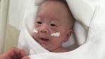 Penampakan Bayi Terkecil di Dunia, Bobotnya Hanya 268 Gram