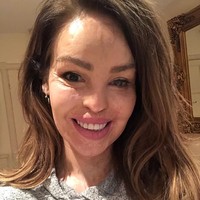 Meski sudah menjalani berbagai operasi plastik, wajah Katie tetap tidak seperti sedia kala. Meski begitu ia tetap tampil percaya diri. Foto: dok. Instagram (@@katiepiper_)