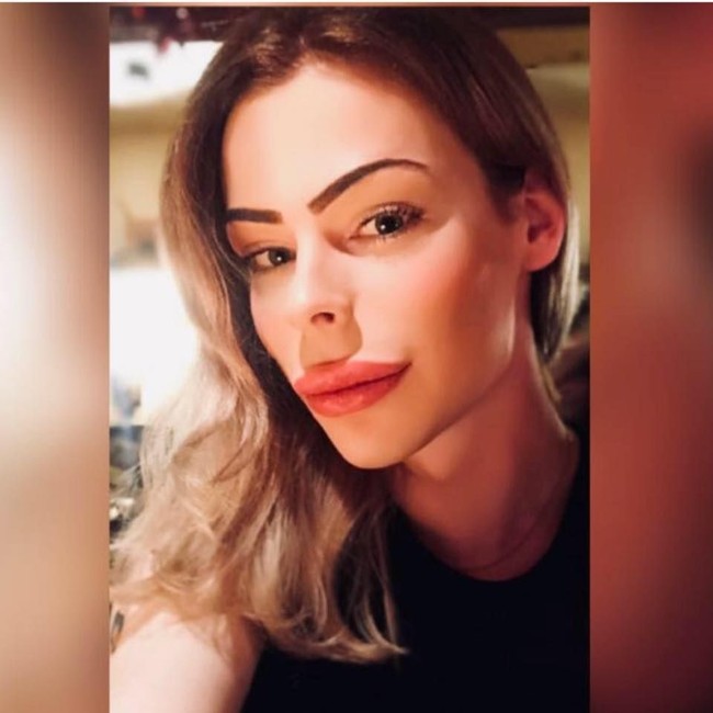 Aku suka dengan penampilan artifisial. Saat aku tumbuh, aku melihat orang semakin banyak operasi plasti dan berpikir seberapa kayanya dia, seperti dia sangat peduli dengan penampilannya, kata Patrick, seperti dikutip dari Express.  Foto: dok. Facebook (Patrick Mast)