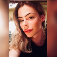 Aku suka dengan penampilan artifisial. Saat aku tumbuh, aku melihat orang semakin banyak operasi plasti dan berpikir seberapa kayanya dia, seperti dia sangat peduli dengan penampilannya, kata Patrick, seperti dikutip dari Express.  Foto: dok. Facebook (Patrick Mast)