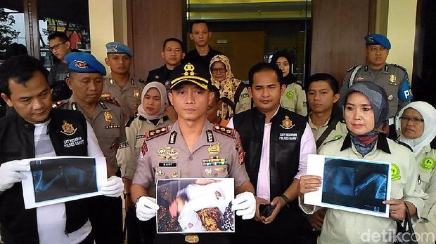 Keji! Ayah Mabuk Patahkan Tangan Bayi Gegara Cekcok