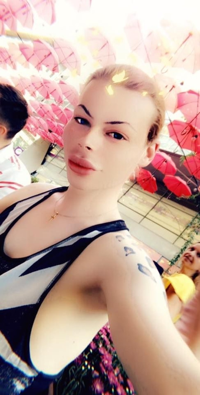 Patrick Mast, pria asal Jerman yang kecanduan dengan botox dan filler telah menghabiskan banyak uang untuk melakukan prosedur tersebut. Pria 24 tahun itu menghabiskan 15 ribu euro atau sekitar Rp 240 juta demi mirip Barbie hidup.  Foto: dok. Facebook (Patrick Mast)