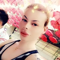 Patrick Mast, pria asal Jerman yang kecanduan dengan botox dan filler telah menghabiskan banyak uang untuk melakukan prosedur tersebut. Pria 24 tahun itu menghabiskan 15 ribu euro atau sekitar Rp 240 juta demi mirip Barbie hidup.  Foto: dok. Facebook (Patrick Mast)