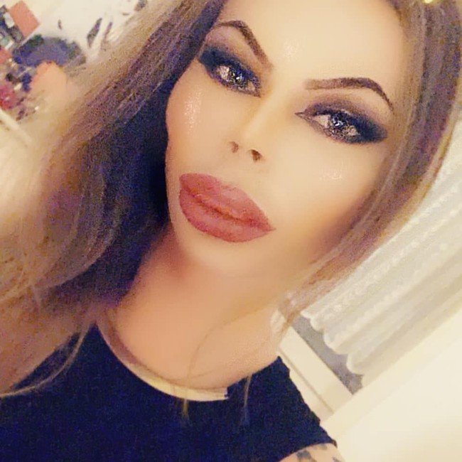 Ia pun memiliki wajah yang terlalu kencang karena kebanyakan botox.  Foto: dok. Facebook (Patrick Mast)