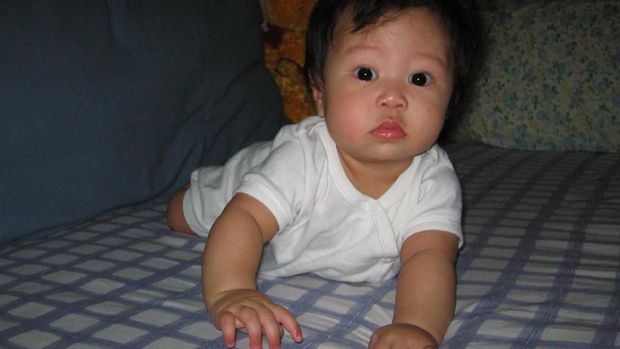 Pengidap penyakit langka Phenylketonuria (PKU).