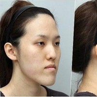 Gadis asal Korea Selatan Shim Yu Ra mengikuti acara realitas Let Me In. Acara ini menghadiahkan mereka dengan makeover penampilan lengkap menggunakan ahli bedah dan prosedur bernilai puluhan ribu dolar. Foto: dok. Koreaboo