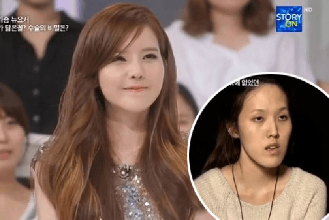 Aku hanya ingin membenahi rahangku ke atas meja bedah, karena orang-orang telah memberiku julukan yang kejam, seperti penyihir dengan payudara kecil, ungkap Yu Ra seperti dilansir dari Koreaboo. Foto: dok. Koreaboo