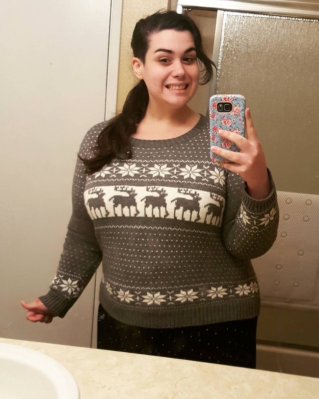 Ketika Amber berusia lima tahun, beratnya sudah mencapai 72 kilogram. Salah satu masalah terbesarnya adalah sulit berjalan. Kondisi tubuhnya inipun mempengaruhi kehidupan sosialnya. Dan pada usia 16 tahun, kondisi kesehatan tubuh Amber menurun sehingga dirinya harus menggunakan kursi roda.Foto: Dok. Instagram @amberrachdi