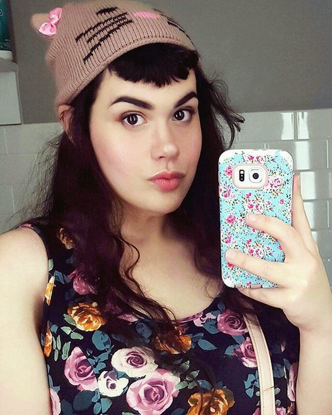 Sebagai permulaan, ia mulai menjalani operasi gastric bypass yang bisa membuat kantung lambung lebih kecil sehingga akan membuatnya merasa kenyang dan mengurangi porsi makan. Foto: Dok. Instagram @amberrachdi