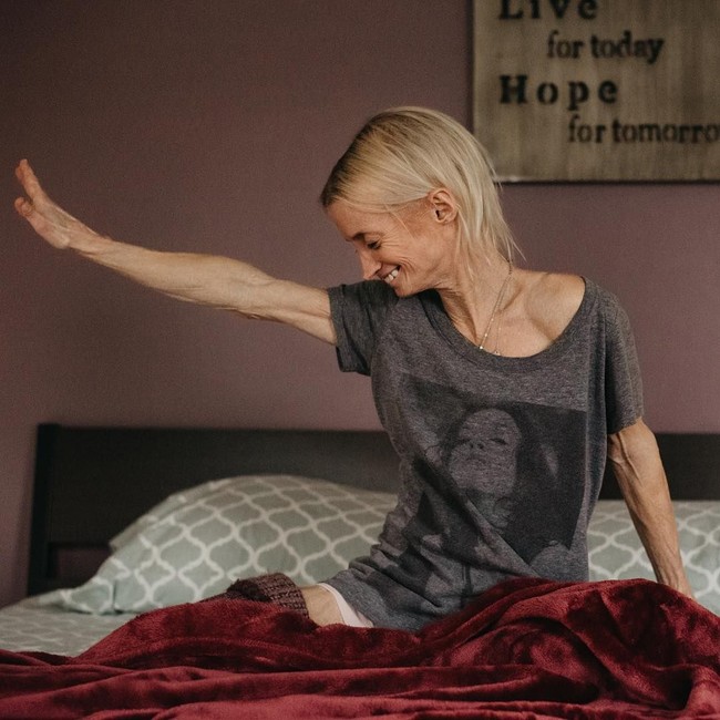 Tiffany tidak mengetahui penyakitnya sejak lahir. Ia dan saudaranya Chad Wedekind baru mengetahui penyakitnya itu saat berusia 20 tahunan. Foto: Dok. Instagram