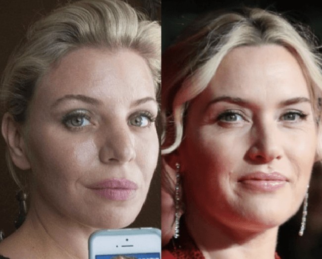 Demi mirip Kate Winslet, Deborah Davenport mengeluarkan uang Rp 212 juta untuk operasi plastik. Prosedur berbahaya pun rela dilakukan wanita asal Texas ini, termasuk mengikir tulang rawan di area hidungnya. Foto: istimewa