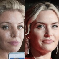 Demi mirip Kate Winslet, Deborah Davenport mengeluarkan uang Rp 212 juta untuk operasi plastik. Prosedur berbahaya pun rela dilakukan wanita asal Texas ini, termasuk mengikir tulang rawan di area hidungnya. Foto: istimewa