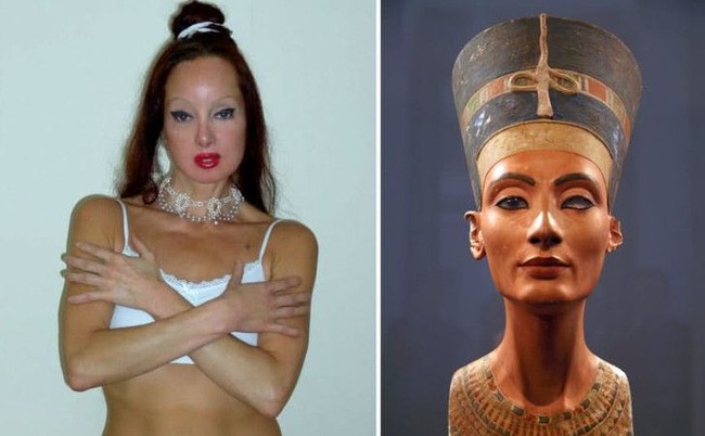 Nileen Namita asal Inggris menggelontorkan uang Rp 3,2 miliar untuk operasi plastik agar wajahnya seperti Ratu Nefertiti, istri Raja Firaun Akhenaten. Uang itu digunakan untuk menjalani 51 kali operasi plastik. Foto: istimewa