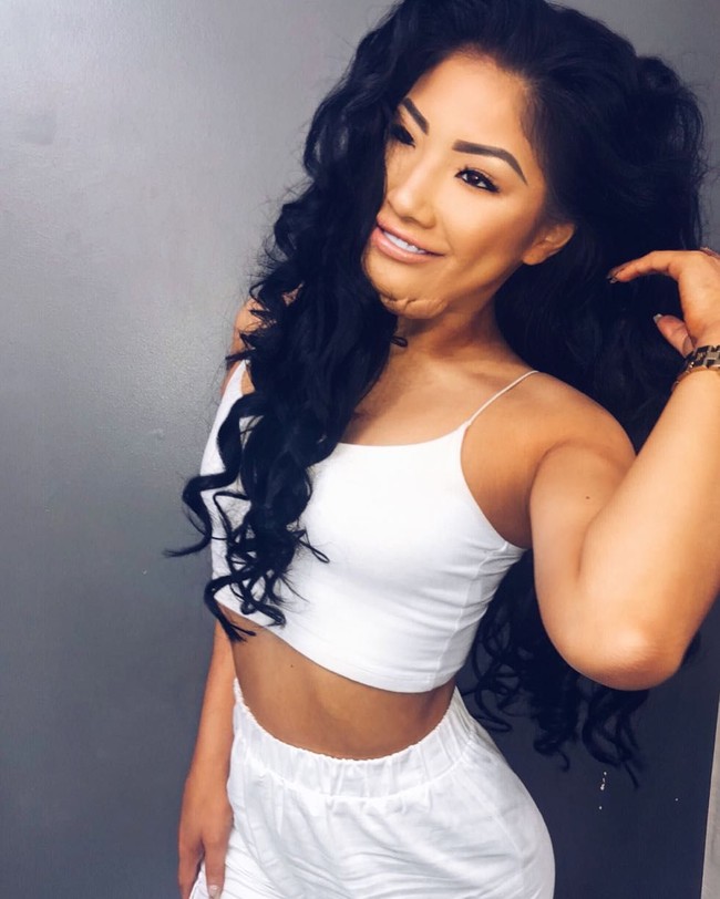 Karena kejadian tersebut ia mendapat hinaan di media sosial. Beberapa orang bahkan mengatakan bahwa Sophie Lee pantas mendapatkannya. Hal tersebut tentu menggangu kesehatan mental wanita 23 tahun tersebut. Foto: Instagram @sophirelee